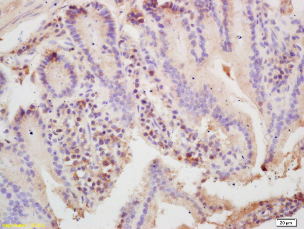 ARP3 Antibody in Immunohistochemistry (Paraffin) (IHC (P))