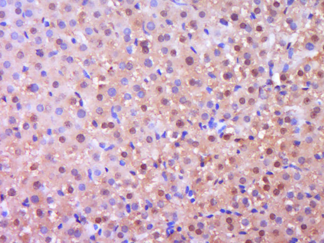 NGFR Antibody in Immunohistochemistry (Paraffin) (IHC (P))