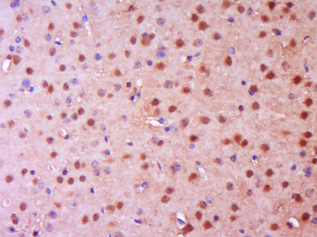 NGFR Antibody in Immunohistochemistry (Paraffin) (IHC (P))