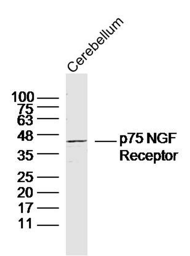 NGFR Antibody in Western Blot (WB)