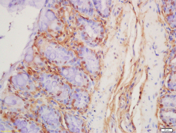 Defensin alpha 6 Antibody in Immunohistochemistry (Paraffin) (IHC (P))