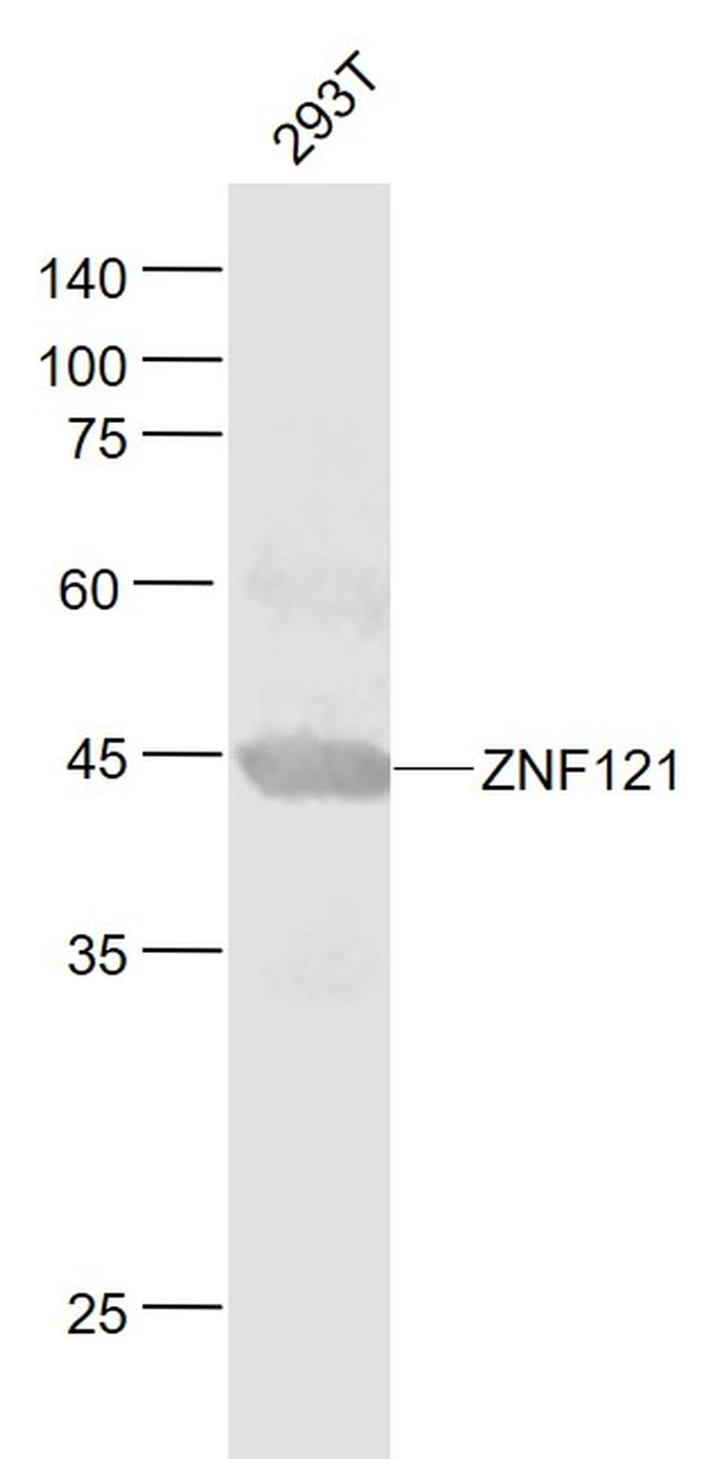 ZNF121 Antibody in Western Blot (WB)