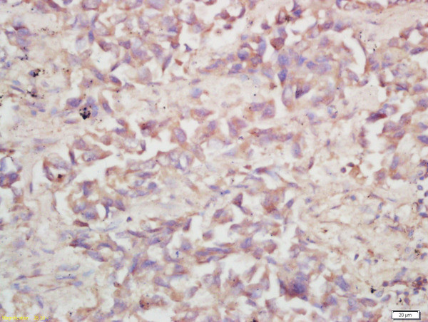 V-ATPase 116 kDa isoform a1 Antibody in Immunohistochemistry (Paraffin) (IHC (P))