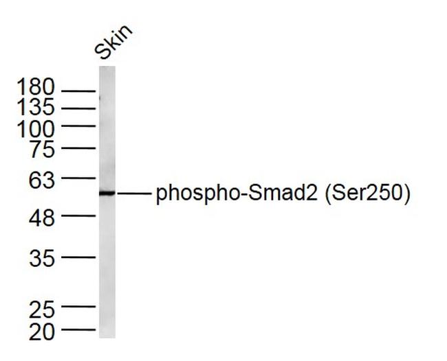 Phospho-Smad2 (Ser250) Antibody in Western Blot (WB)