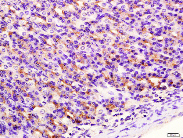 SIRT4 Antibody in Immunohistochemistry (Paraffin) (IHC (P))