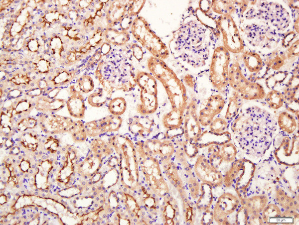 SIRT4 Antibody in Immunohistochemistry (Paraffin) (IHC (P))