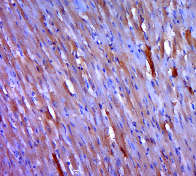 SERCA1 ATPase Antibody in Immunohistochemistry (Paraffin) (IHC (P))