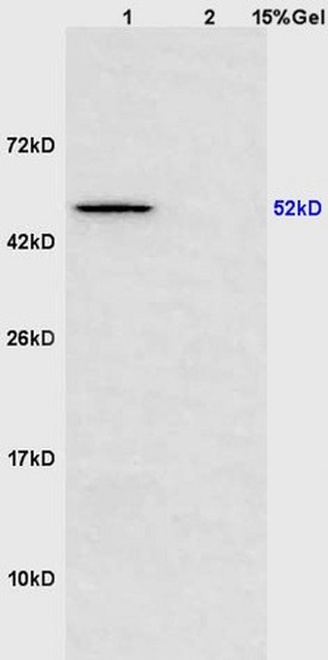 Scavenger Receptor BII Antibody in Western Blot (WB)