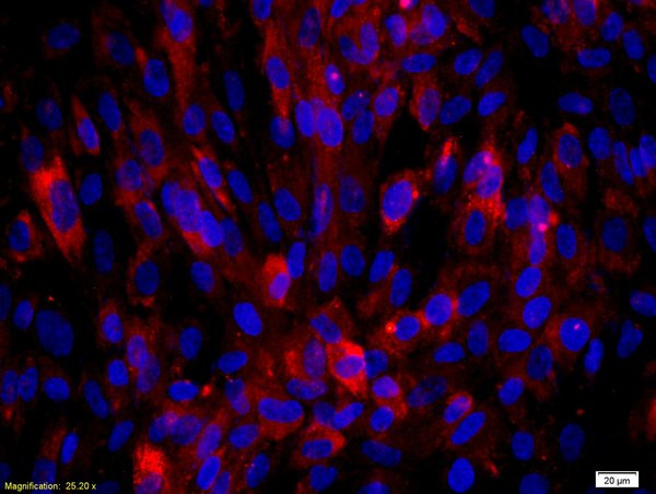 Biglycan Antibody in Immunocytochemistry (ICC/IF)