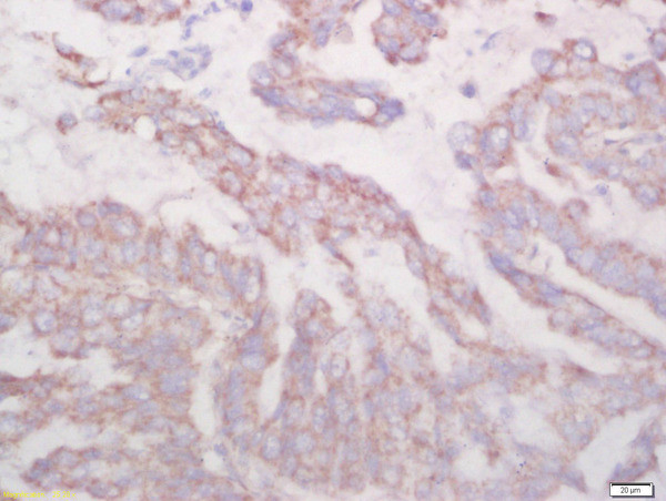 Biglycan Antibody in Immunohistochemistry (Paraffin) (IHC (P))