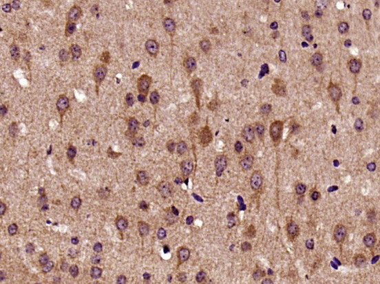 Biglycan Antibody in Immunohistochemistry (Paraffin) (IHC (P))