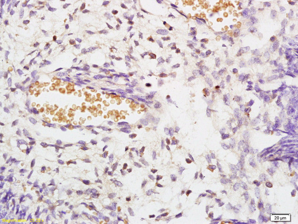 STK3+STK4 Antibody in Immunohistochemistry (Paraffin) (IHC (P))