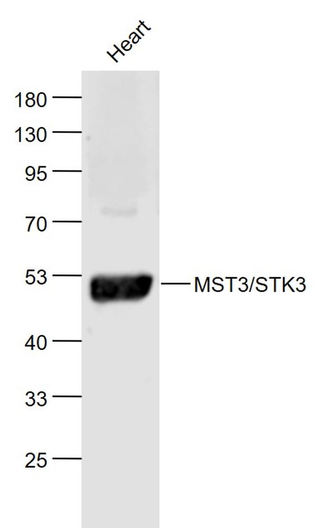 STK3+STK4 Antibody in Western Blot (WB)