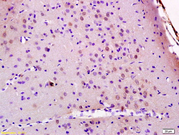 JMY Antibody in Immunohistochemistry (Paraffin) (IHC (P))