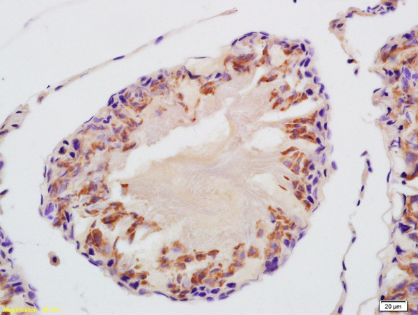 VDAC3 Antibody in Immunohistochemistry (Paraffin) (IHC (P))