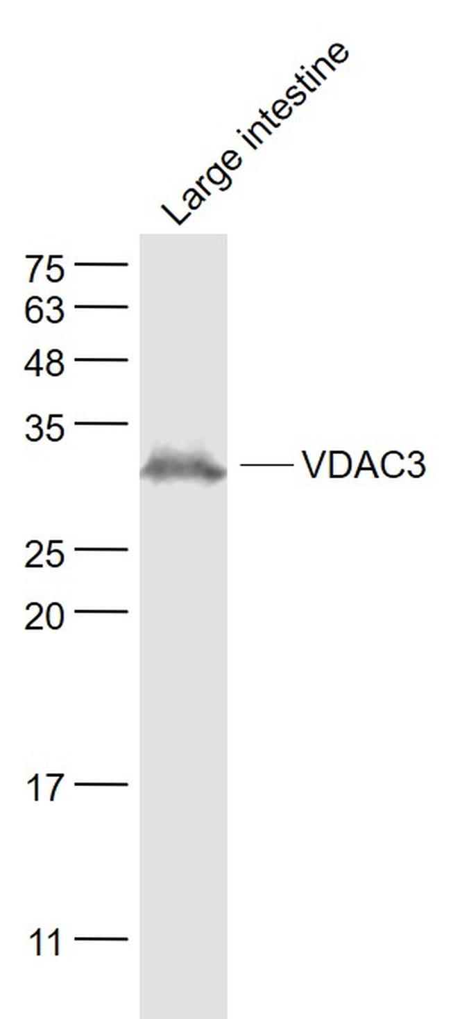 VDAC3 Antibody in Western Blot (WB)