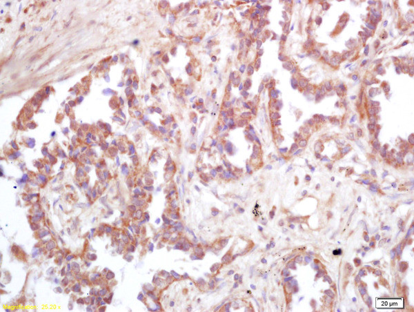 ATP6IP2 Antibody in Immunohistochemistry (Paraffin) (IHC (P))