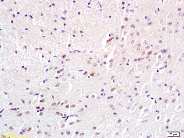 Adenovirus 5 E1A binding protein Antibody in Immunohistochemistry (Paraffin) (IHC (P))