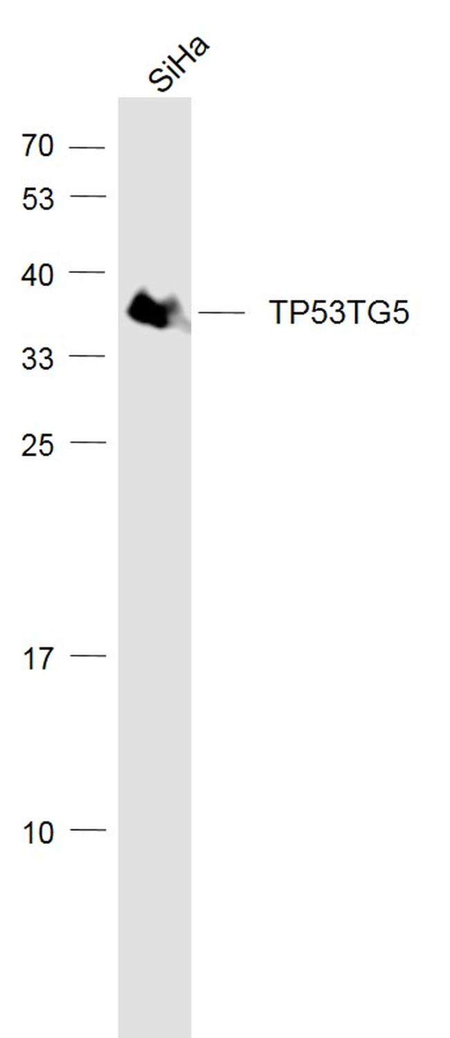 TP53TG5 Antibody in Western Blot (WB)