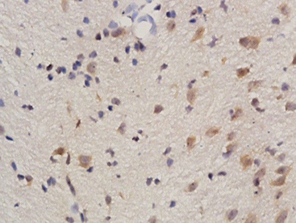 Phospho-REC8 (Ser251) Antibody in Immunohistochemistry (Paraffin) (IHC (P))