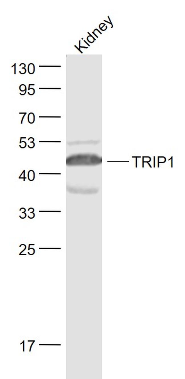 TRIP1 Antibody in Western Blot (WB)