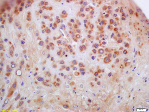 Anillin Antibody in Immunohistochemistry (Paraffin) (IHC (P))