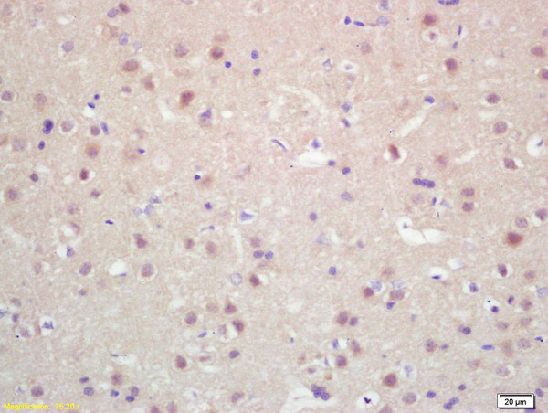 MKLP2 Antibody in Immunohistochemistry (Paraffin) (IHC (P))