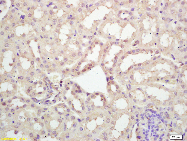 MKLP2 Antibody in Immunohistochemistry (Paraffin) (IHC (P))