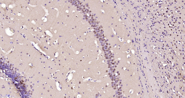 NUSAP1 Antibody in Immunohistochemistry (Paraffin) (IHC (P))