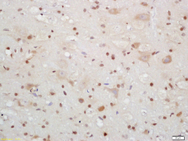 CIRBP Antibody in Immunohistochemistry (Paraffin) (IHC (P))