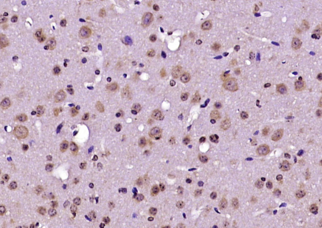 RABGAP1 Antibody in Immunohistochemistry (Paraffin) (IHC (P))