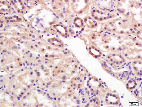 RCL Antibody in Immunohistochemistry (Paraffin) (IHC (P))