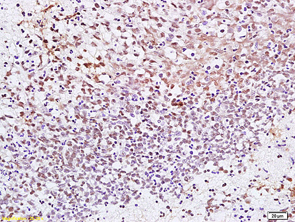 CENPF Antibody in Immunohistochemistry (Paraffin) (IHC (P))