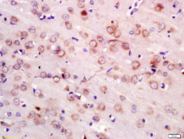 NEDD4 Antibody in Immunohistochemistry (Paraffin) (IHC (P))