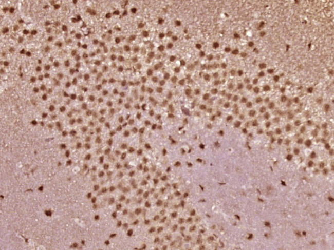 VHLH Antibody in Immunohistochemistry (Paraffin) (IHC (P))