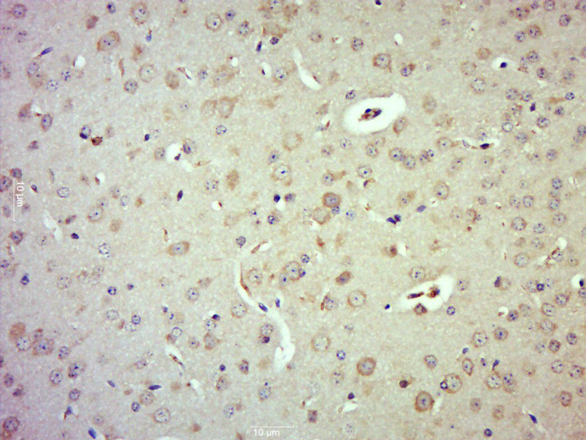 Phospho-LATS1 (Thr1079) Antibody in Immunohistochemistry (Paraffin) (IHC (P))