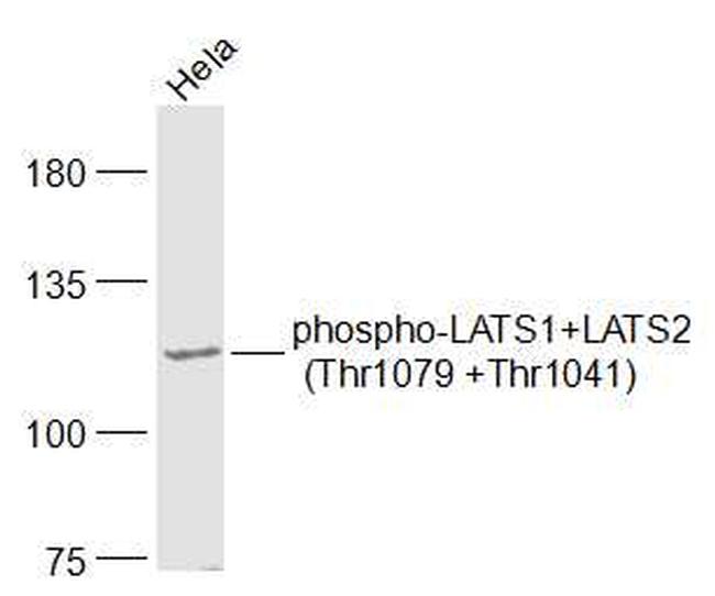 Phospho-LATS1 (Thr1079) Antibody in Western Blot (WB)