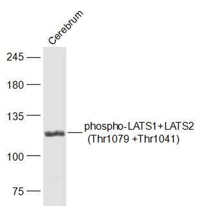 Phospho-LATS1 (Thr1079) Antibody in Western Blot (WB)