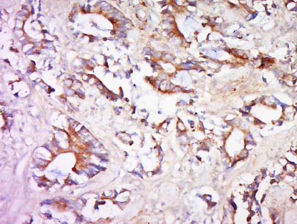 SIPA1L2 Antibody in Immunohistochemistry (Paraffin) (IHC (P))