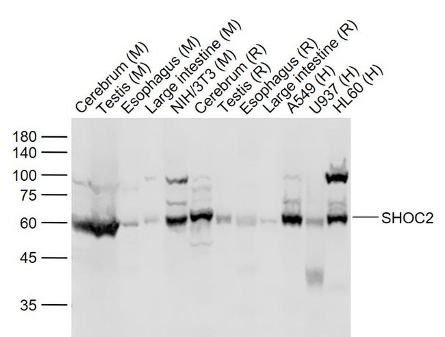 SHOC2 Antibody in Western Blot (WB)