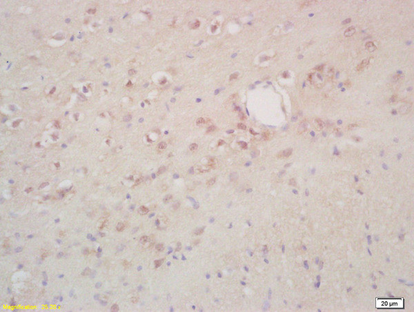 Phospho-NK (Thr234) Antibody in Immunohistochemistry (Paraffin) (IHC (P))