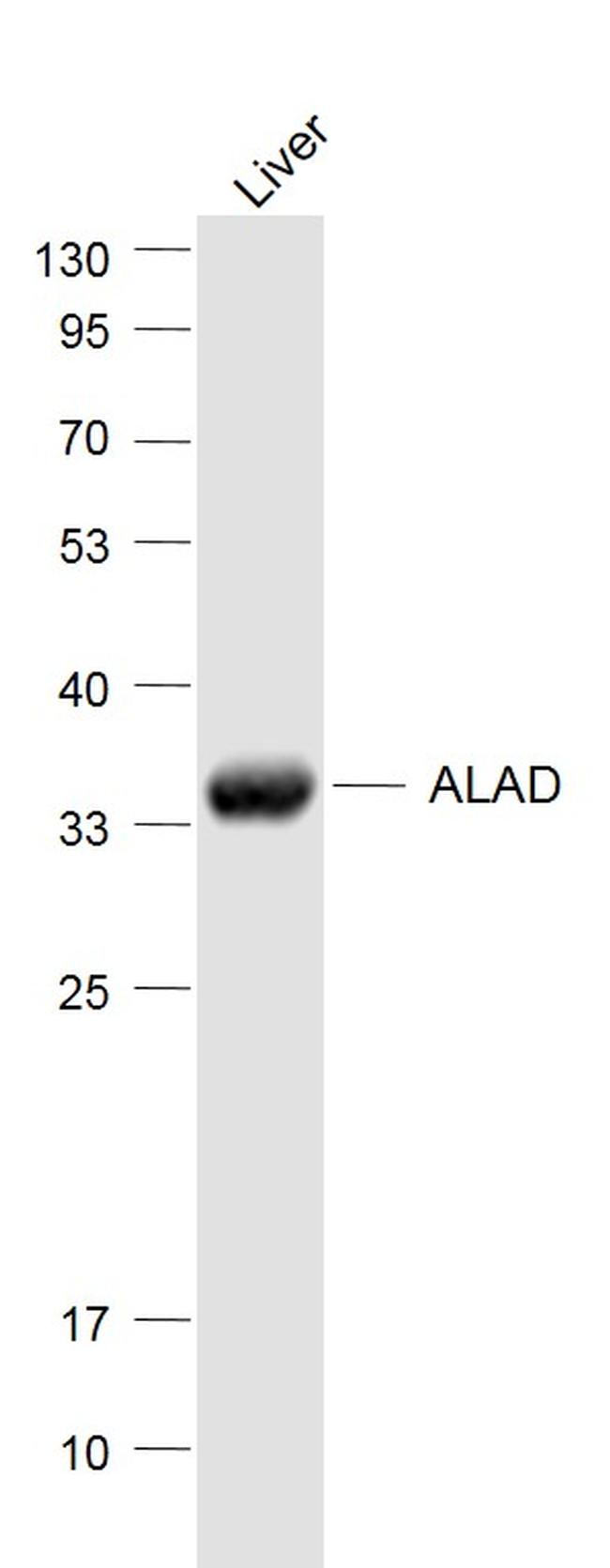 ALAD Antibody in Western Blot (WB)