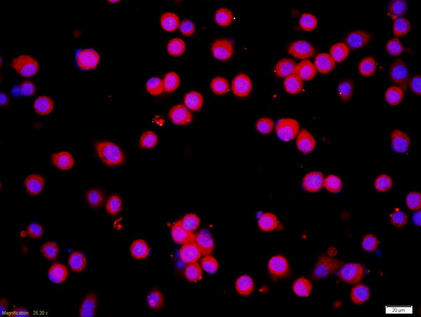 ICMT Antibody in Immunocytochemistry (ICC/IF)