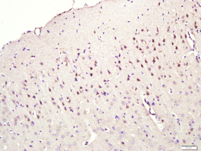 CNIH2/3 Antibody in Immunohistochemistry (Paraffin) (IHC (P))