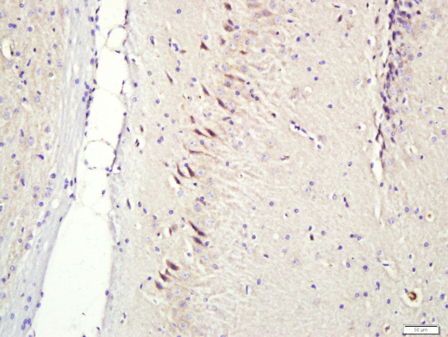 CNIH2/3 Antibody in Immunohistochemistry (Paraffin) (IHC (P))