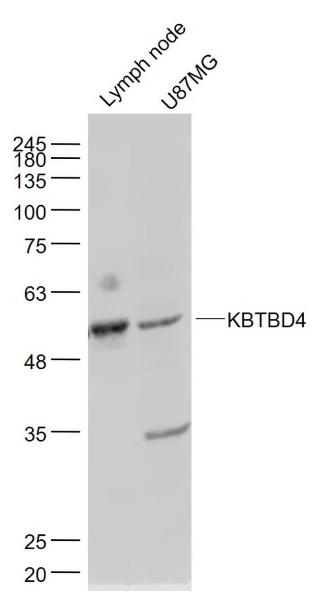 KBTBD4 Antibody in Western Blot (WB)