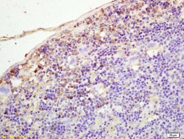 PLEKHM2 Antibody in Immunohistochemistry (Paraffin) (IHC (P))