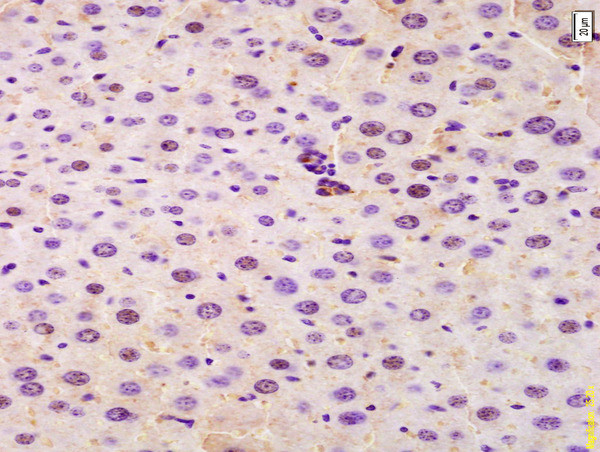 SRRM2 Antibody in Immunohistochemistry (Paraffin) (IHC (P))