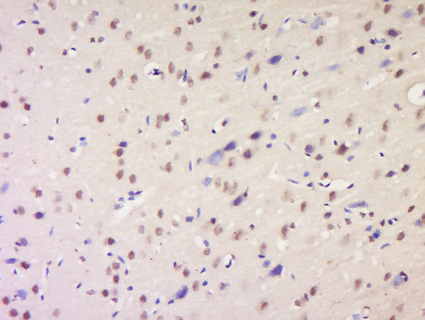 NSD1 Antibody in Immunohistochemistry (Paraffin) (IHC (P))