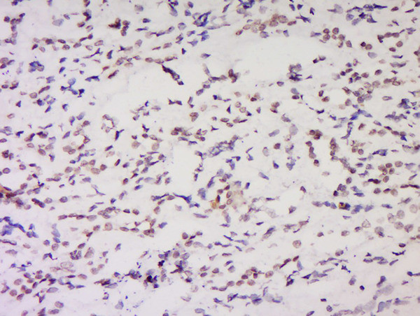 NSD1 Antibody in Immunohistochemistry (Paraffin) (IHC (P))